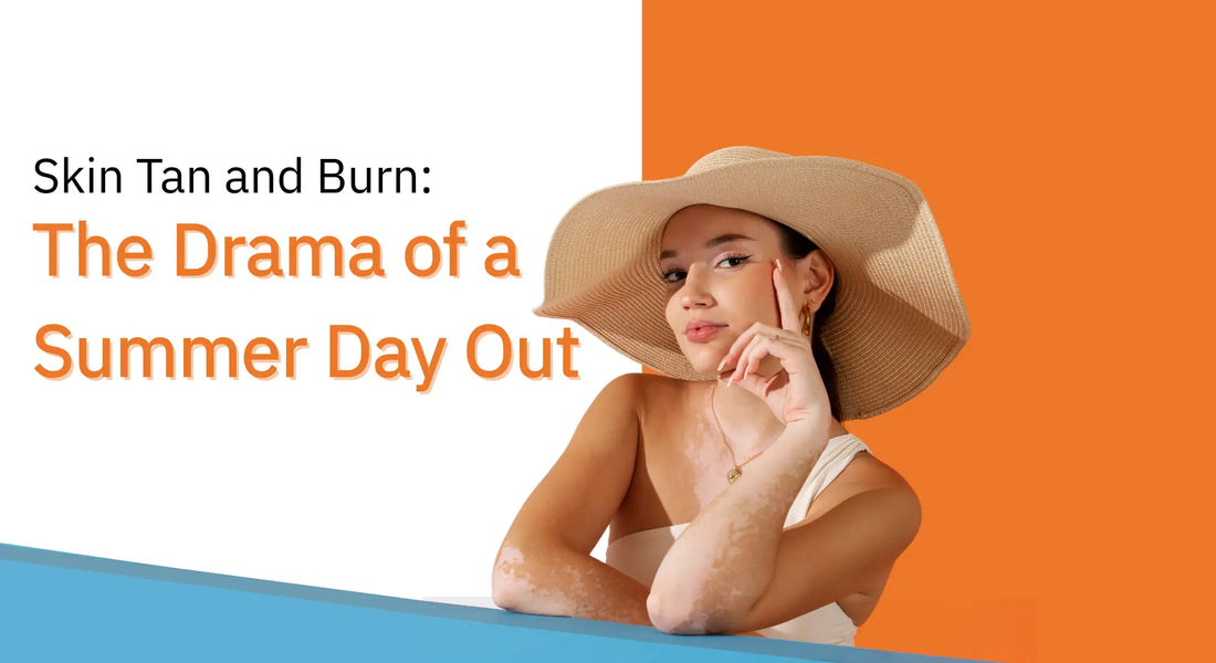 Skin Tan and Burn: The Drama of a Summer Day Out
