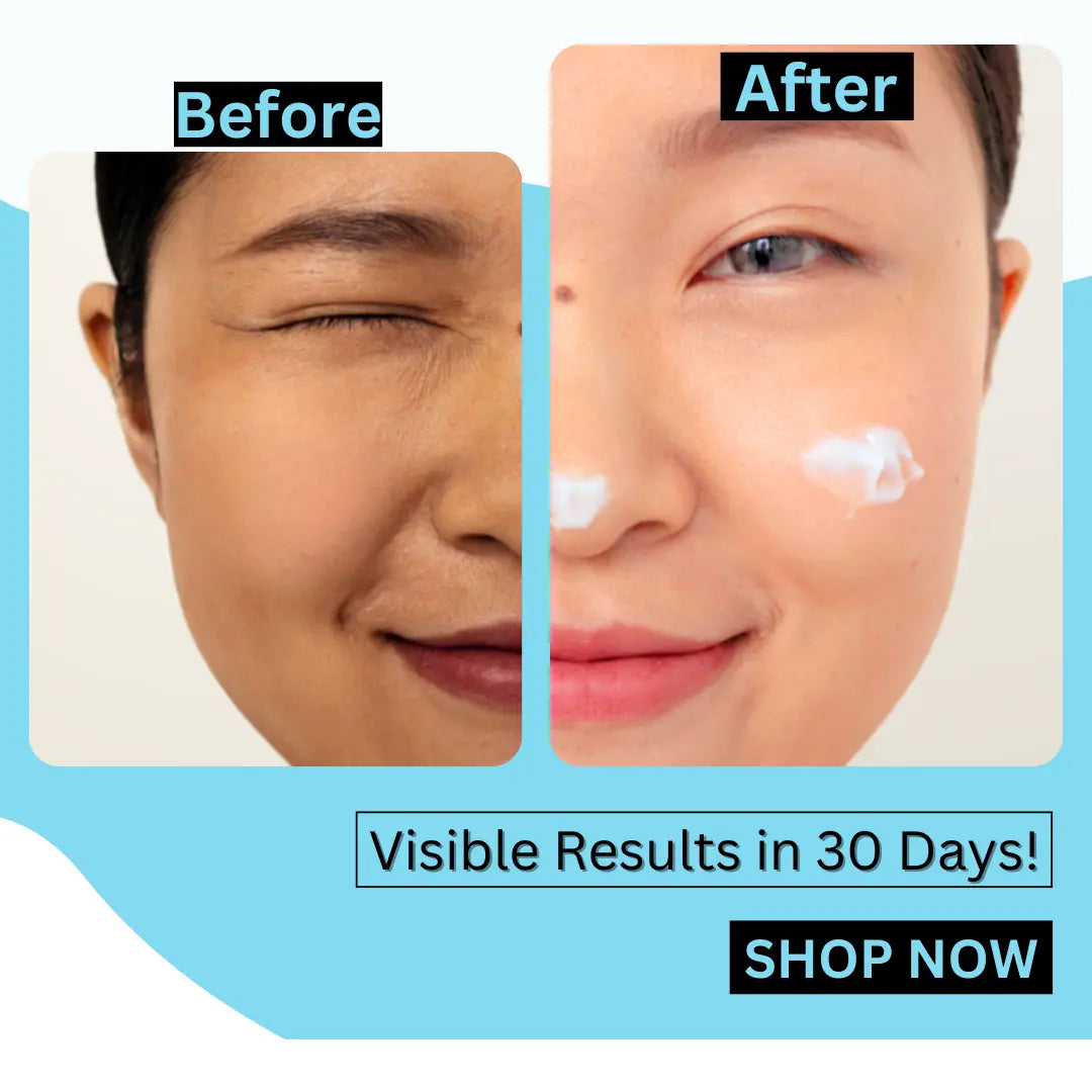 Glutathione cream