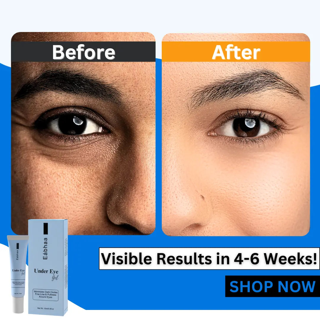 Eabhaa Under Eye Gel (15 ml) – Brightening, Anti-Aging, Dark Circles, India
