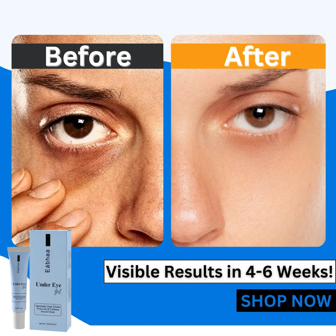 Eabhaa Under Eye Gel (15 ml) – Brightening, Anti-Aging, Dark Circles, India