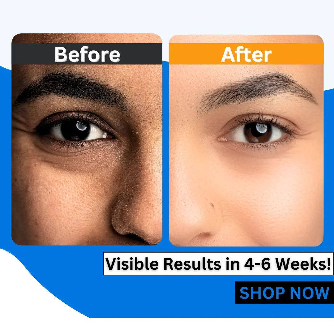 Eabhaa Under Eye Gel (15 ml) – Brightening, Anti-Aging, Dark Circles, India