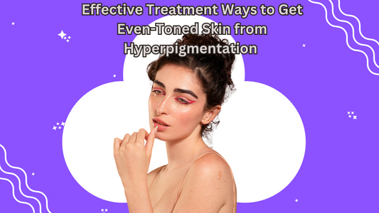 Effective Treatment Ways to Get Even-Toned Skin from Hyperpigmentation