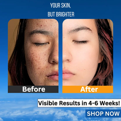 Before and after image of a woman showing improvement from tan pigmentated skin to brighter glowing skin using Vitamin C face Serum