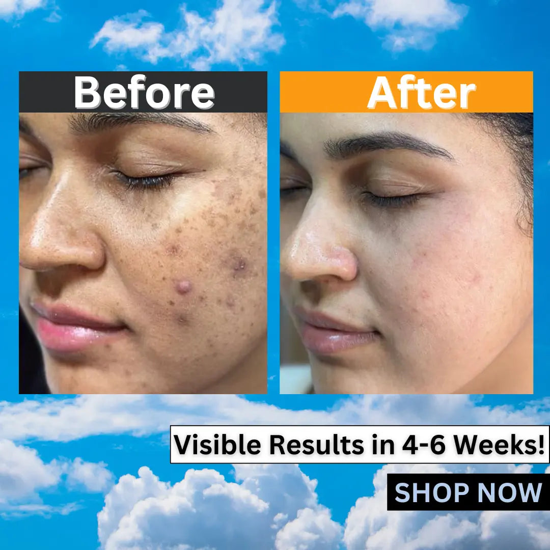 Eabhaa Glutathione & Vitamin C Face Cream for Women & Men (50g)