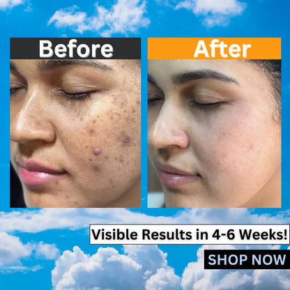 Eabhaa Glutathione & Vitamin C Face Cream for Women & Men (50g)