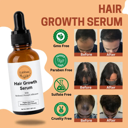 Eabhaa Hair Growth Serum for Women & Men (50ML) – Best Serum in India